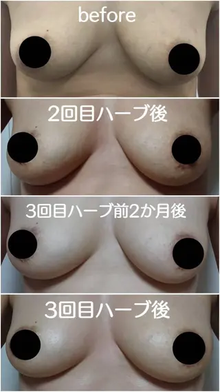 オールハンド フェイシャルのエステ・リラクイメージ