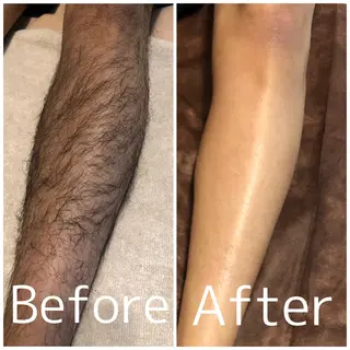 メンズ MiEL total beauty salon所属・脱毛サロン MiELのエステ・リラクイメージ