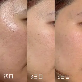 エステティックサロン Liente(リアンテ)所属・Hashimoto .のエステ・リラクイメージ