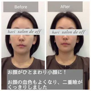 整体×美容鍼灸 鍼灸師Miyanoのエステ・リラクイメージ