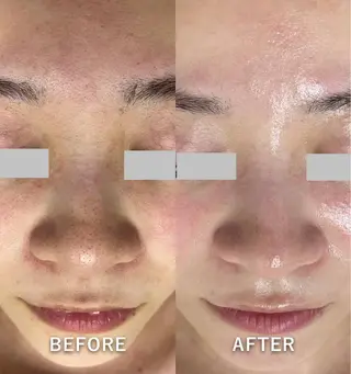 韓国美肌/肌質改善 【天神】yuiのエステ・リラクイメージ