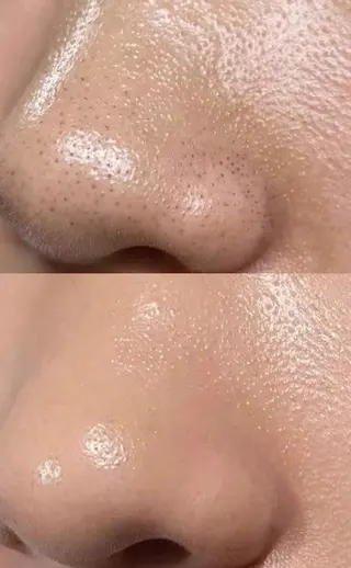 鍼灸整体サロンAIM所属・塩見 信之のエステ・リラクイメージ