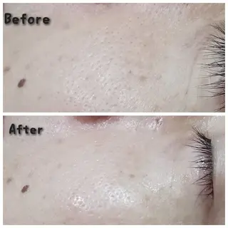 エスティックサロン Moon-bell所属・エステティクサロン Moon-bellのエステ・リラクイメージ