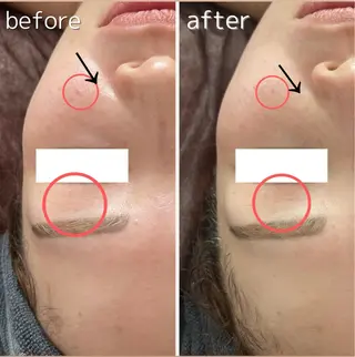 ReN所属・ReN エステサロンのエステ・リラクイメージ