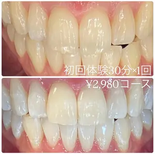 PLATINUM Beauty 横浜店所属・ホワイトニングルーム 横浜店のその他イメージ