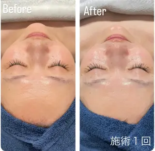 アンド ミルルのエステ・リラクイメージ