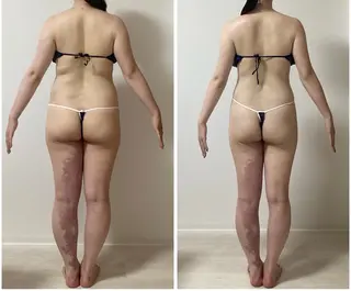 ハイパーナイフ痩身 Misakiのエステ・リラクイメージ