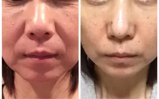 ショート shiro's 久保田のエステ・リラクイメージ