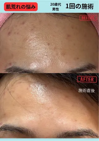 akua... 【肌質管理専門】のその他イメージ