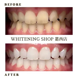 メンズ ホワイトニング ショップ葛西店のその他イメージ