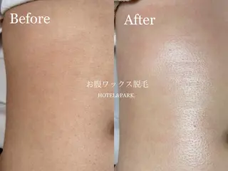 HOTEL&PARK . ワックス脱毛のエステ・リラクイメージ