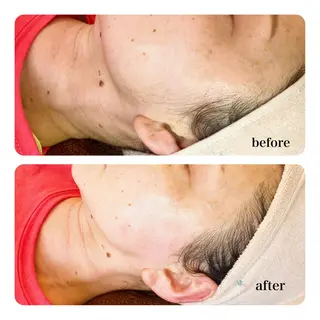 多摩境Beauty Salon  ViVi所属・多摩境ViVi chinamiのエステ・リラクイメージ