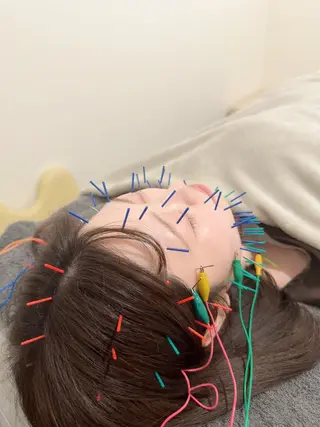 美容鍼＆鍼灸サロン 鍼Glitter.所属・田中 美奈のエステ・リラクイメージ