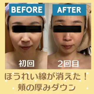 小顔矯正サロン プルメリアのエステ・リラクイメージ