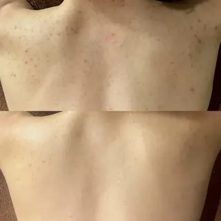 LEPUS (レプス)sasaのエステ・リラクイメージ