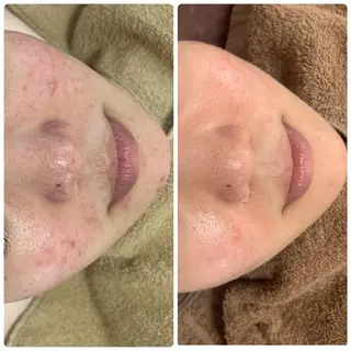 beautysalon  LINO所属・平日限定！お得！ 全メニュ¥5,500のエステ・リラクイメージ