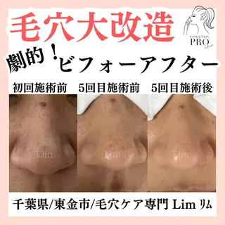 Lim Naomiのマツエク・マツパデザイン