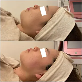 ララ/ハーブ メゾンリュバンのエステ・リラクイメージ