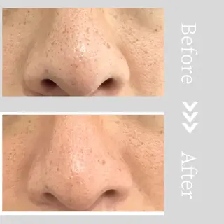 小顔・ツルツル素肌 ハリステリアのエステ・リラクイメージ