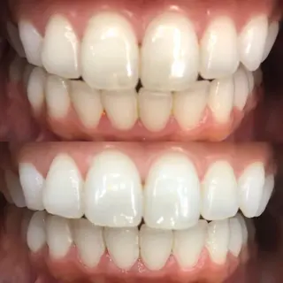 LBSホワイトニング 🌐梅田店公式のその他イメージ