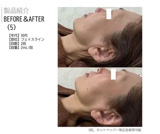 ベルーテ エッセンスのエステ・リラクイメージ