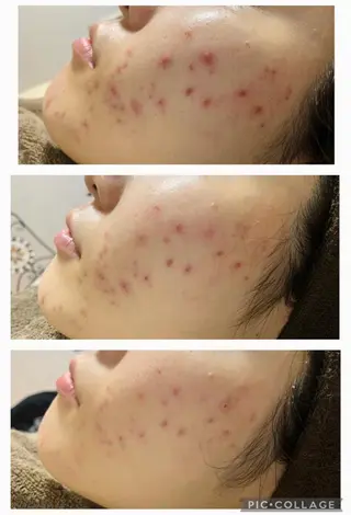 ミディアム カラー パーマ ヘアアレンジ メンズ キッズ ネイル マツエク・マツパ アイブロウ 肌質体質を変えて すっぴん肌にのエステ・リラクイメージ