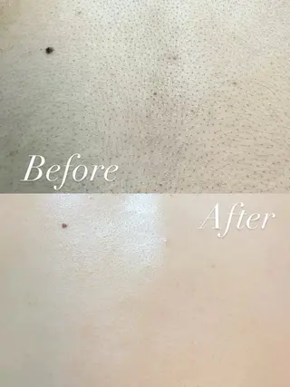 Hit. シュガーリング豊橋のエステ・リラクイメージ