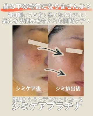 エステサロン グラマラスのエステ・リラクイメージ