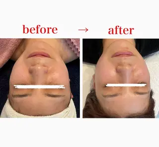 menard_fa cial&bodyのエステ・リラクイメージ