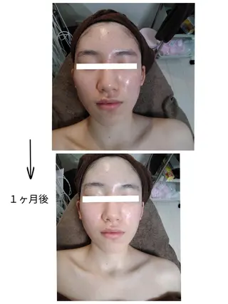 フェイシャルサロン オーガニックロハスのエステ・リラクイメージ