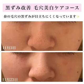 Bellesthe (ベルエステ)のエステ・リラクイメージ