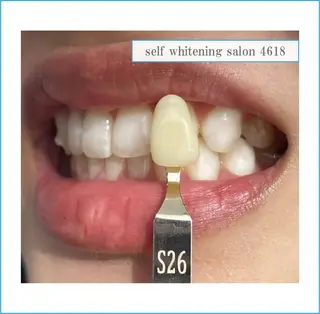 self whitening salon 4618所属・ホワイトニングサロン 4618のその他イメージ