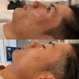 素肌キレイLab.所属・≪ニキビケア≫ 素肌キレイLab.のエステ・リラクイメージ