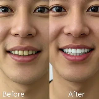 歯科提携セルフダック 宇都宮駒生店のエステ・リラクイメージ