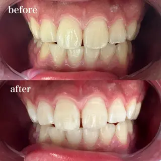 Mr.&Ms. 脱毛 /眉毛ワックス/まゆのエステ・リラクイメージ