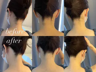 うなじ脱毛/美肌脱毛 LABELのエステ・リラクイメージ