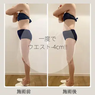 痩身＆ヘッド 長倉絵美のエステ・リラクイメージ