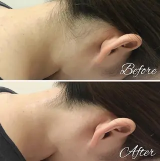 脱毛・小顔専門サロンLUANA所属・脱毛&シェービング 専門店　平岡のその他イメージ