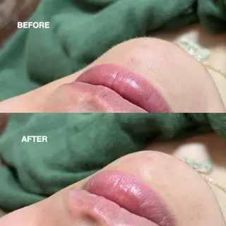 お顔そりルーム小春空所属・＊ HARUKAのその他イメージ