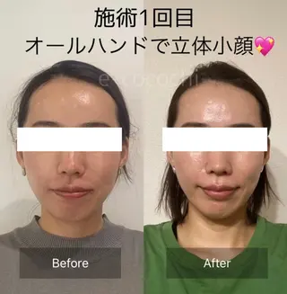 小顔と ヘッドスパのお店のエステ・リラクイメージ