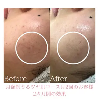 BestBelleꕤ 大阪福島/肌質改善のエステ・リラクイメージ