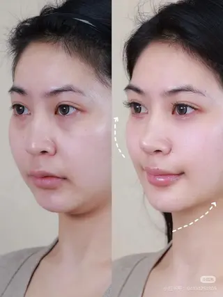 カラー aliaハイフ&水光ジェットサロン所属・aliaハーブ水光店 エステティシャン募集のエステ・リラクイメージ