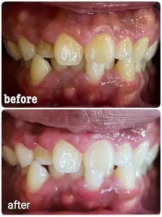 ホワイトニングサロン ラウレアのその他イメージ