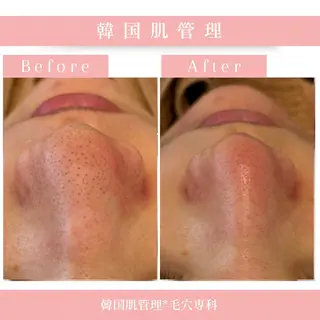 韓国肌管理 【毛穴専科】のエステ・リラクイメージ