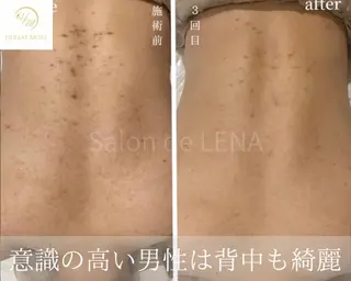 ハーブピーリング・毛穴ケア専門サロンSalon de LENA 栄店所属・ハーブピーリング専門 サロンドレナ　白藤のエステ・リラクイメージ