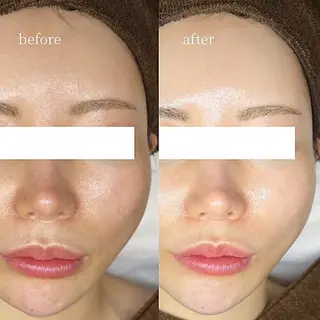 韓国肌管理・肌質改善 EARNEST心斎橋のエステ・リラクイメージ