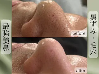 Rairy所属・Rairy Salon富士見町のエステ・リラクイメージ