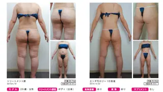 オレンジバナナ 新潟店のエステ・リラクイメージ