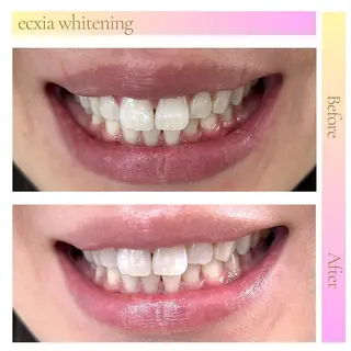 セルフホワイトニング エクシア新百合ヶ丘店のその他イメージ