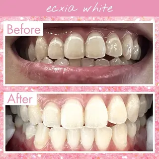 libuR total beauty salon所属・エクシアホワイト 碧南店りりかのその他イメージ